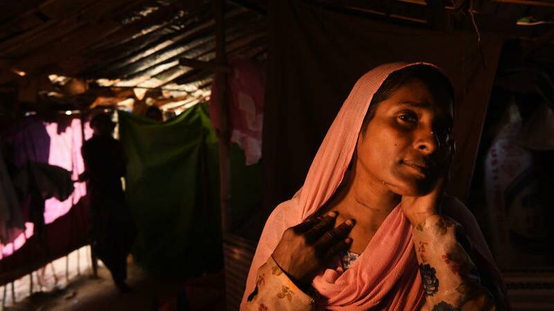 Almas Khatun reveals the scars from where her throat and face were cut by the Myanmar military and monks. Photo: Kate Geraghty