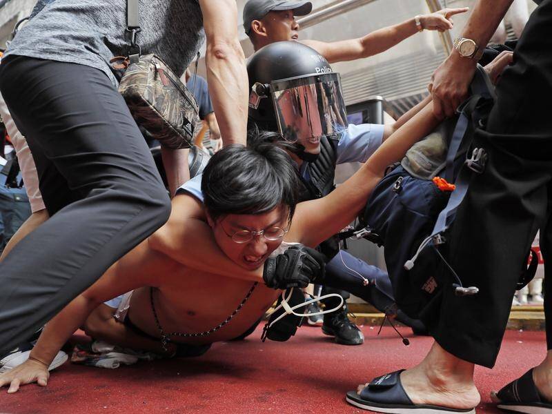 Hong Kong protesters have told Amnesty they were beaten with batons while in police custody.